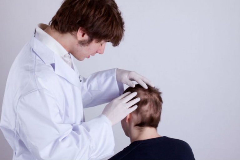 Common Questions Philadelphia Residents Have About Hair Restoration