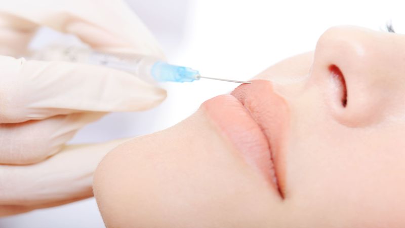 Finding a Clinic That Offers Fillers and Botox in Surrey