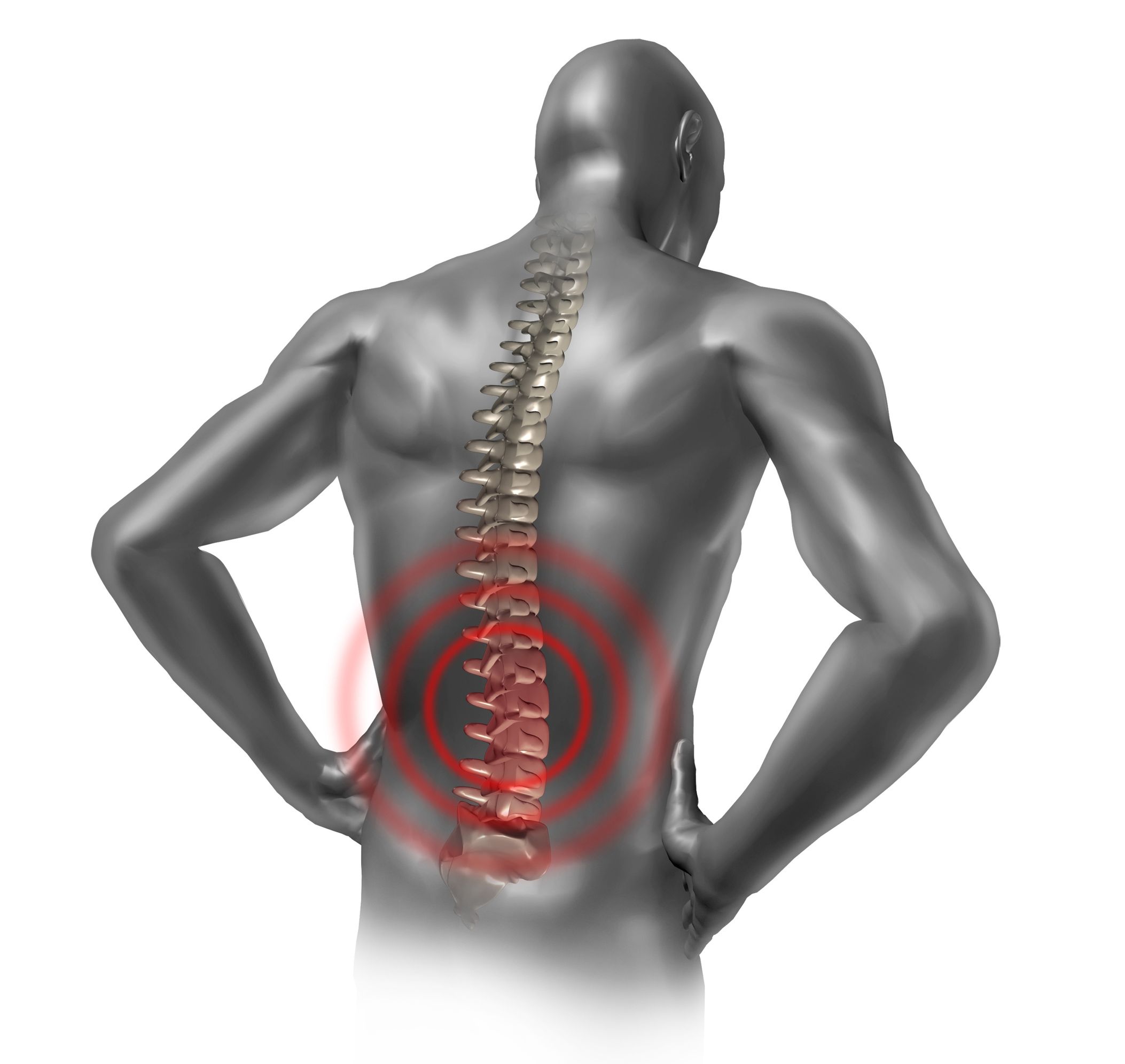 Helping You Feel Better with Spinal Canal Decompression in Dunedin