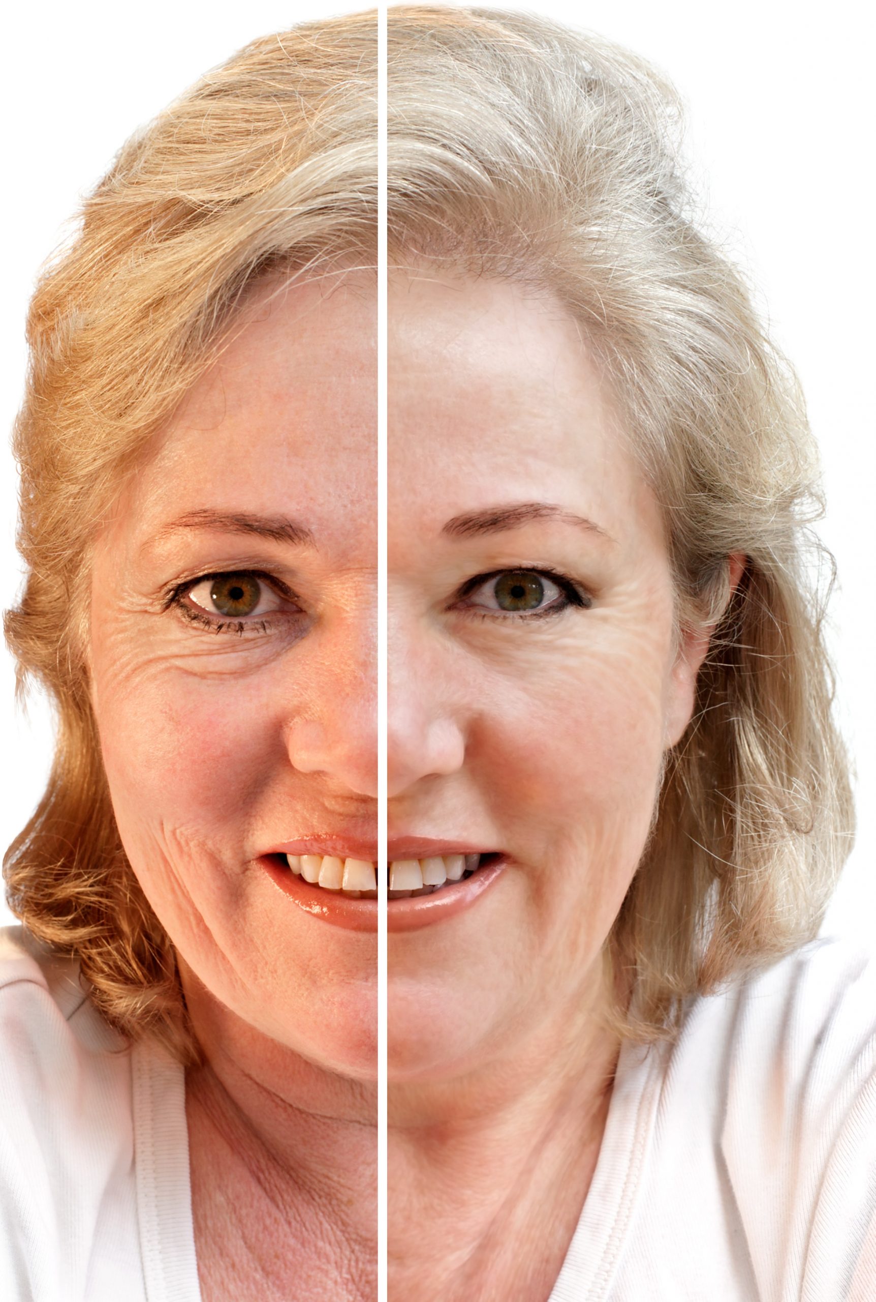 How Facial Rejuvenation in Savannah Can Boost Your Confidence