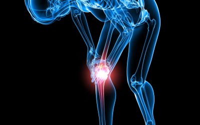 Revitalize Your Life with Advanced Treatments at a Premier Knee Pain Clinic in Latham, NY