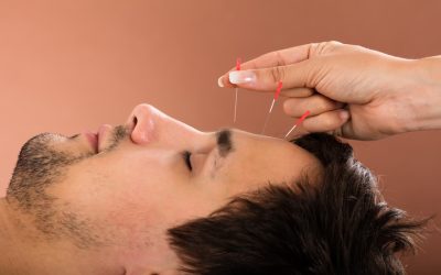 Unlock the benefits of acupuncture treatment in Costa Mesa, CA for a healthier life