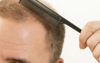 Get fuller, healthier hair with advanced hair loss restoration in Pine Bluff,AR