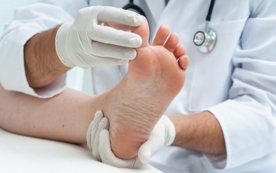 Unparalleled Foot and Ankle Treatment Options Offered by a Trusted Podiatrist in Marietta, GA